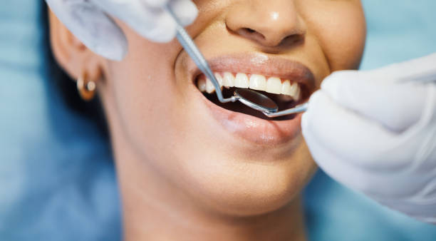Best Emergency Dental Care for Broken or Chipped Teeth in Oakdale, LA