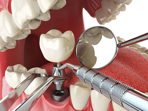 Best Same-Day Emergency Dental Services in Oakdale, LA