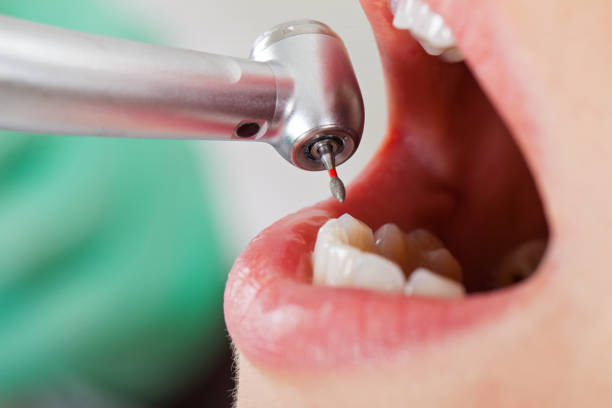 Best Pediatric Emergency Dentist in Oakdale, LA